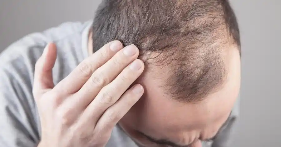 Hair Transplant Centre in Chandigarh