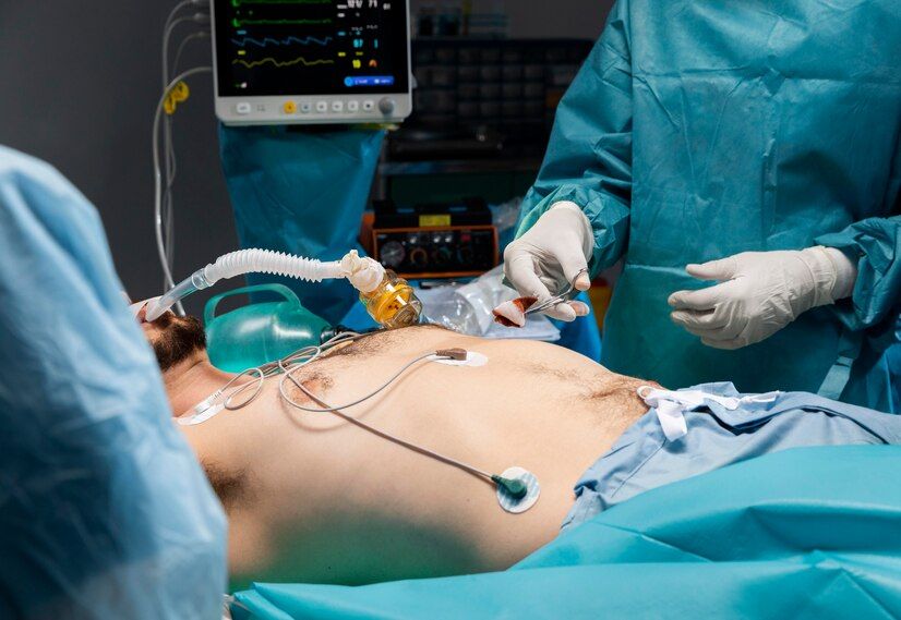 Bariatric Surgery