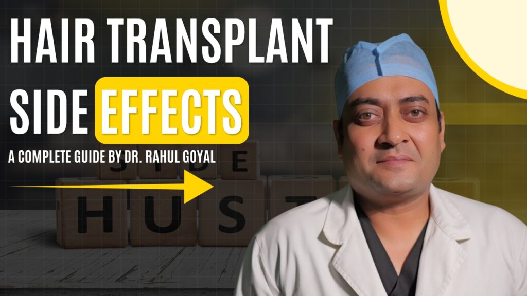 Hair Transplant Side Effects: A Complete Guide by Dr. Rahul Goyal