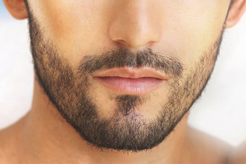 Moustache Hair Transplant