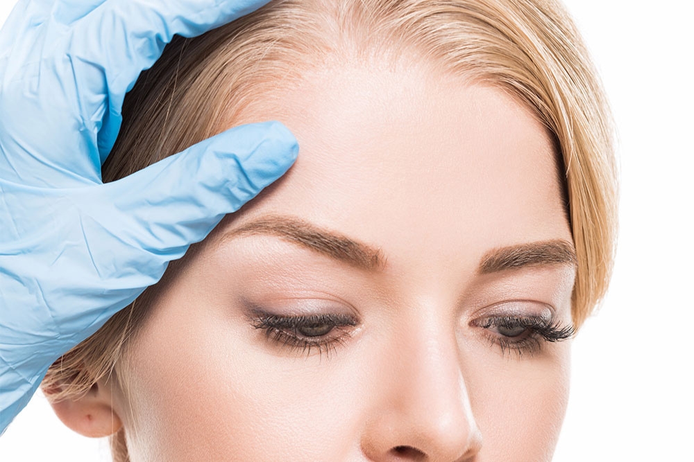 Brow Lift