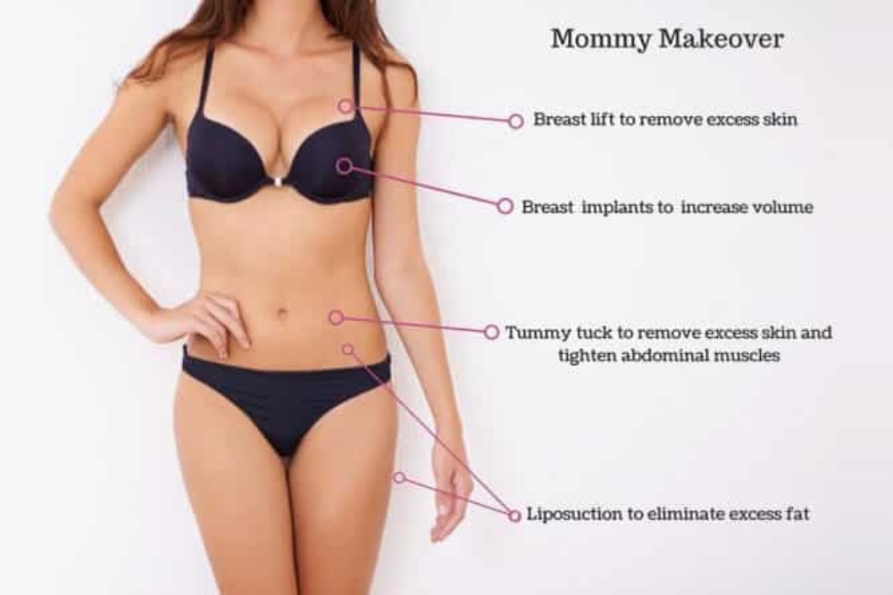 Mommy Makeover