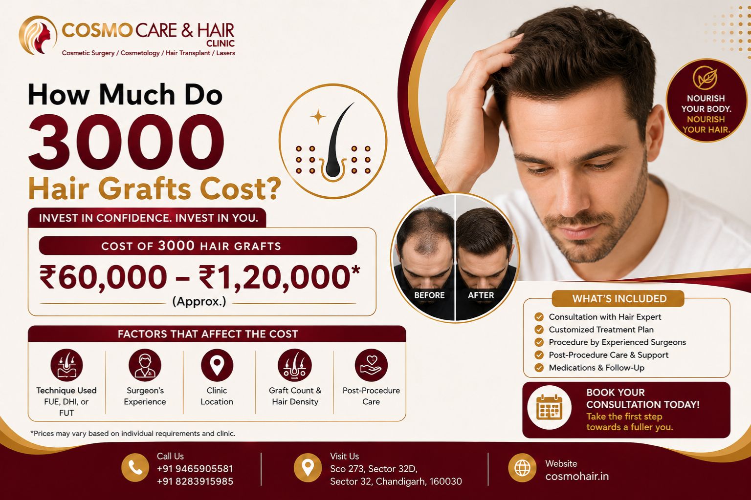 How Much Do 3000 Hair Grafts Cost?