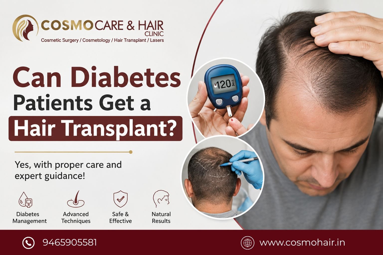 Can Diabetes Patients Get a Hair Transplant