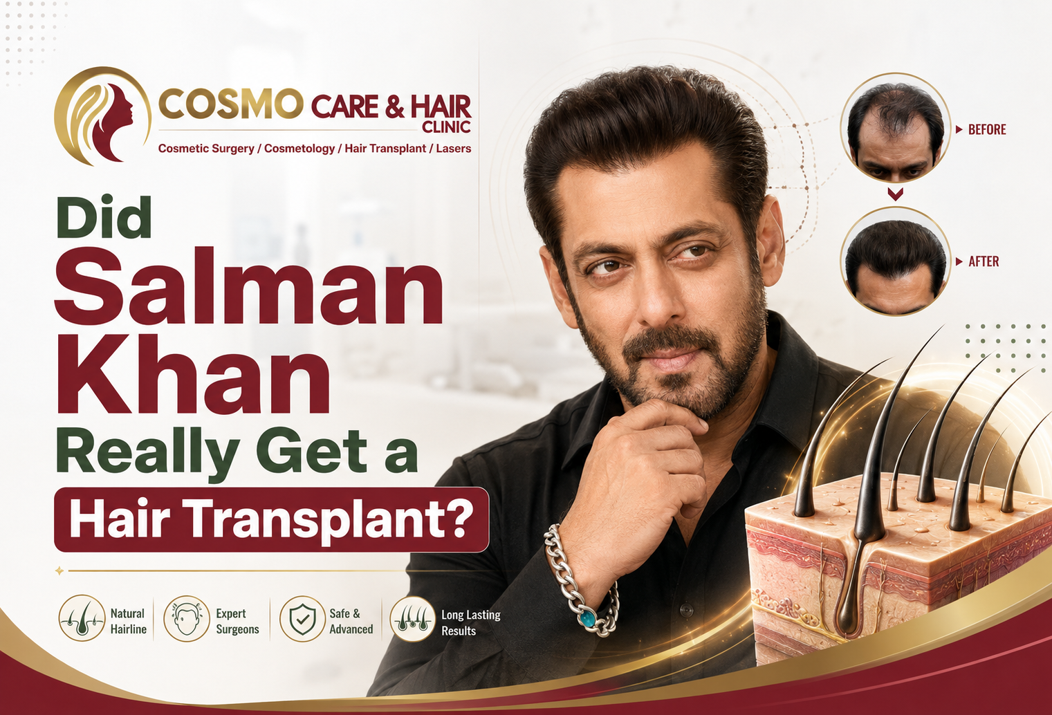 Did Salman Khan Really Get a Hair Transplant