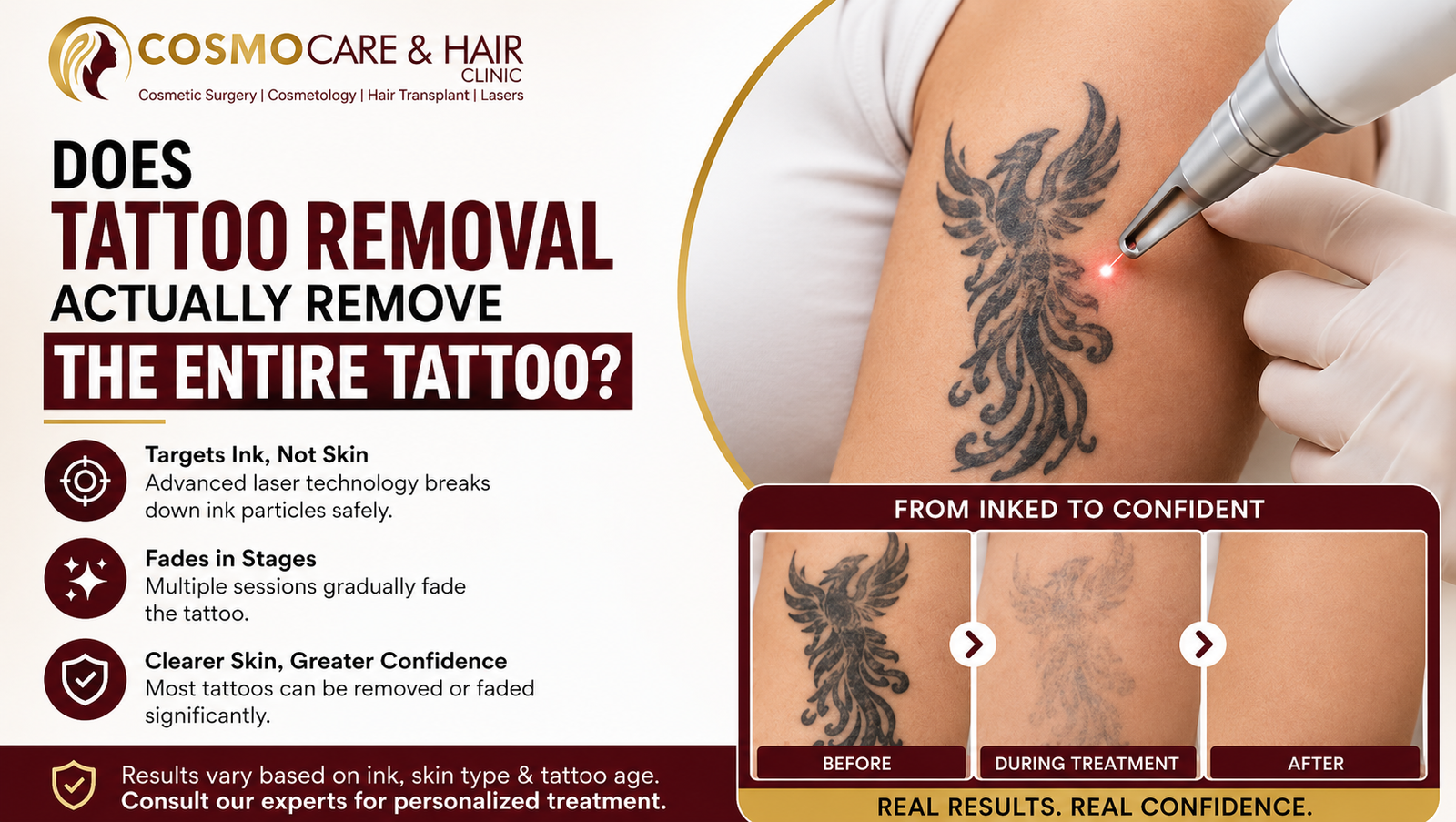 Does Tattoo Removal Actually Remove the Entire Tattoo