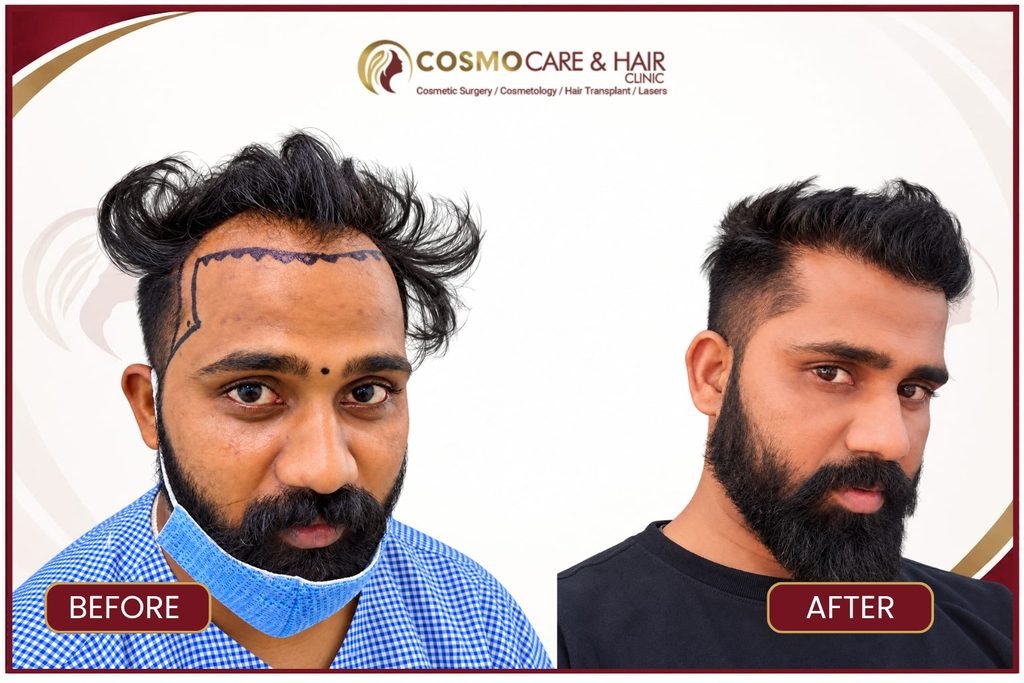 Before-and-After Photos a Fair Comparison